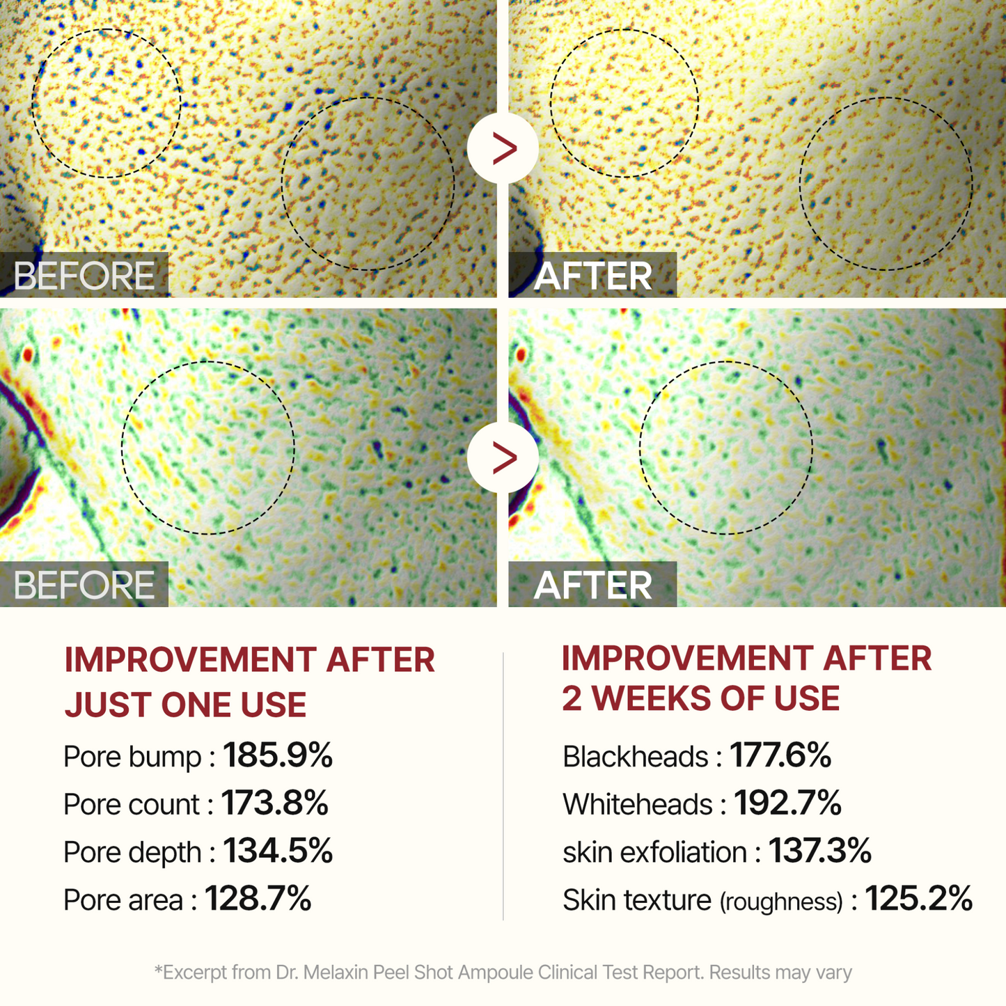 [Dr.Melaxin] Peel Shot Exfoliating White Rice Ampoules