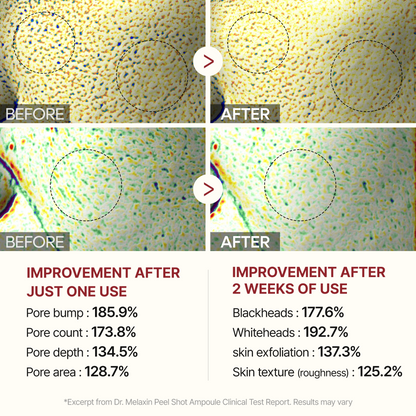 [Dr.Melaxin] Peel Shot Exfoliating White Rice Ampoules